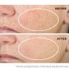 StriVectin by StriVectin Multi-Action Super-C Retinol Brighten & Correct vitamin C Serum --30ml/1oz